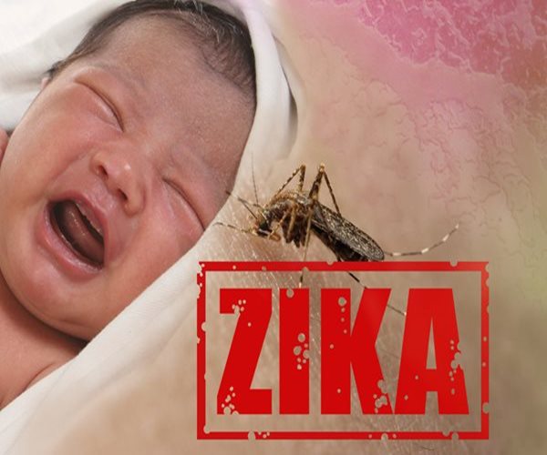 Pregnant Women With Zika Have Up to 13 Percent Risk of Microcephaly