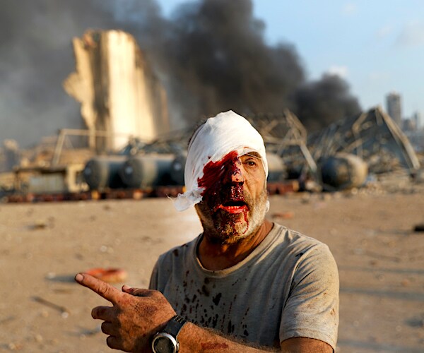 a bloodied headed man points and speaks in front of the beirut explosion site