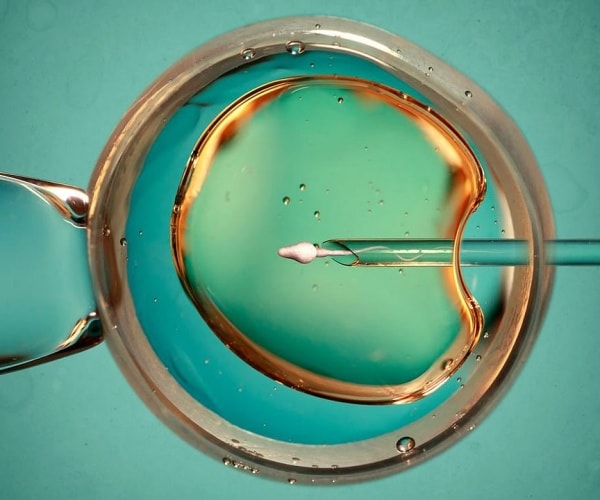 microscopic view of insemination for fertility treatment