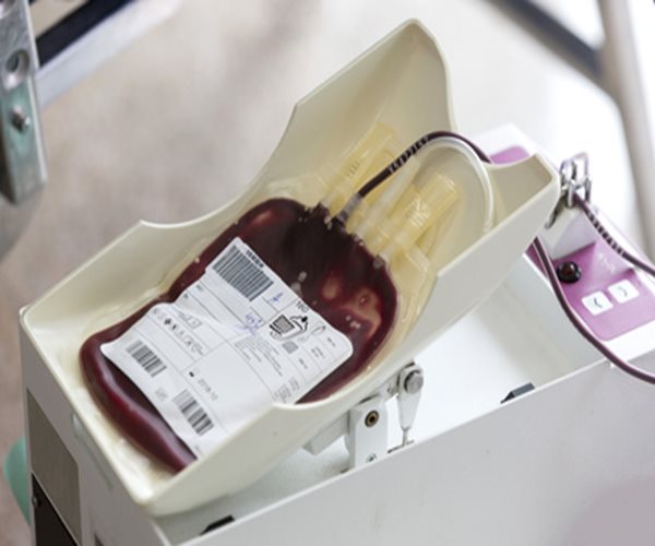 Age, Sex of Blood Donor May Impact Patient Outcome