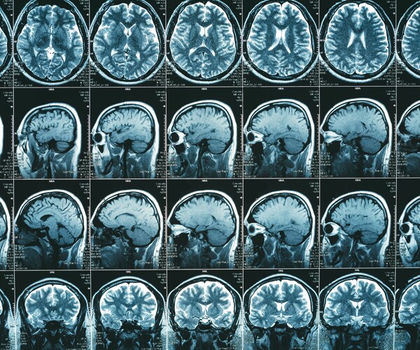 Images from a brain MRI