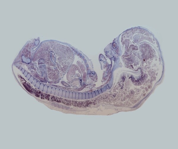 a mouse embryo