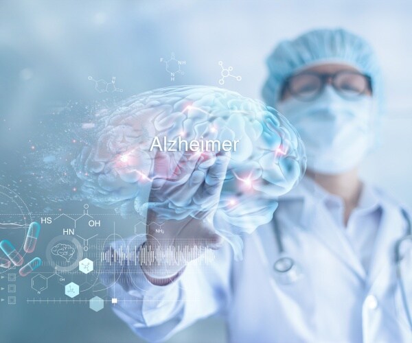 scientist looking at brain on screen that says "Alzheimer's disease"