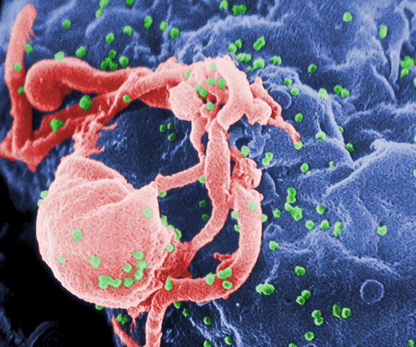 Expert: Genetic Cure for AIDS Possible