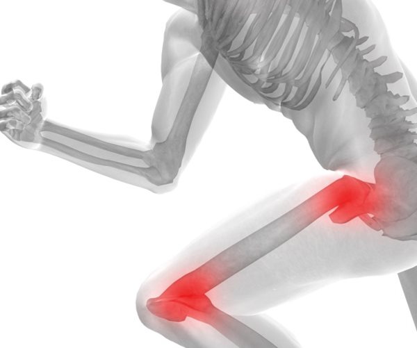 New Bone Drug Effective in Trial