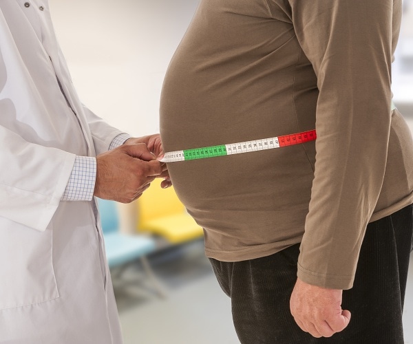 doctor measuring obese man