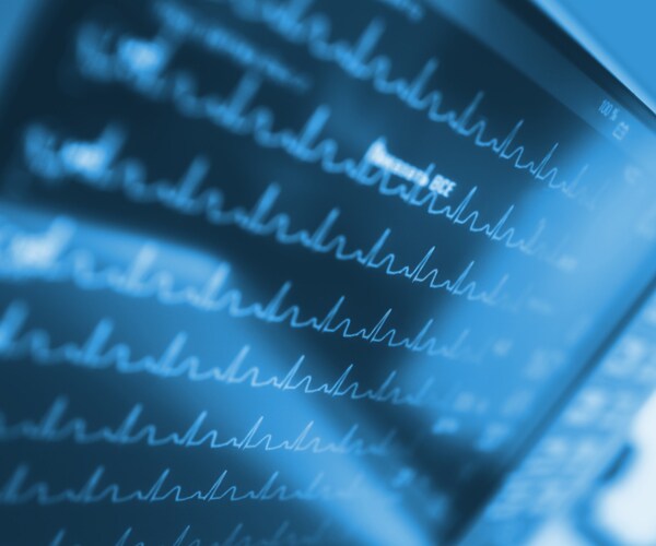 heart rate monitor in a hospital