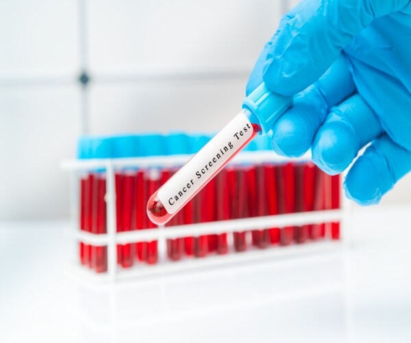 New Blood Test Can Detect 50 Different Cancers