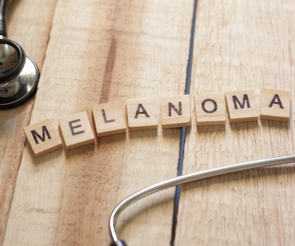 melanoma spelled out with blocks