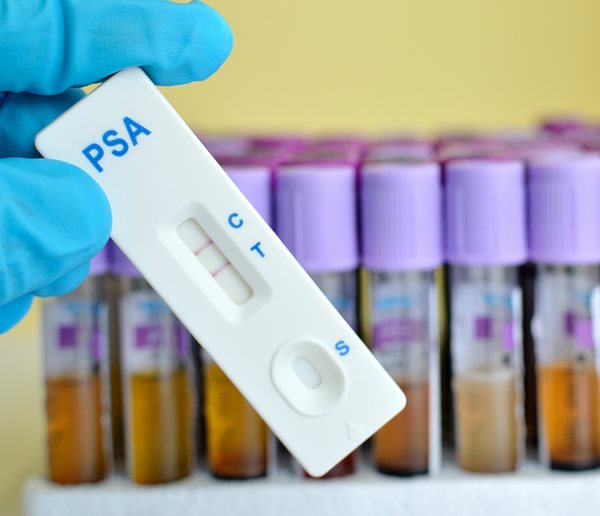 Some Seniors Get Unnecessary Cancer Screenings