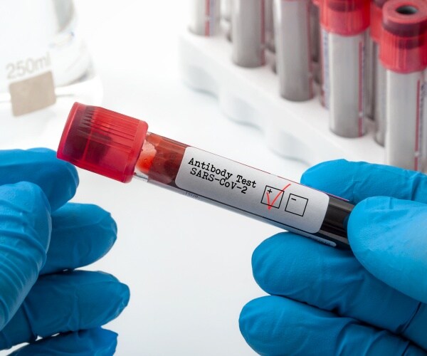 lab blood test for antibodies to COVID