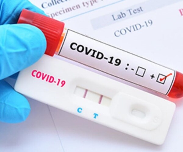 positive tests for COVID