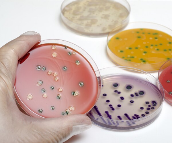 Meijer Listeria Recall Includes Packaged Vegetables in 6 States