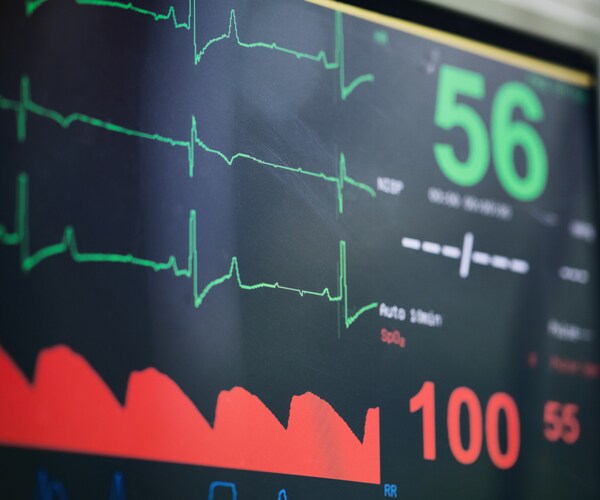 a heart rate displayed on a monitor