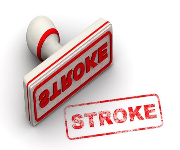 1 in 3 May Have Had Warning Stroke and Not Know It