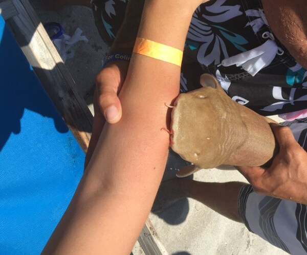 Woman Bitten by Shark That Wouldn't Let Go Even After It Died