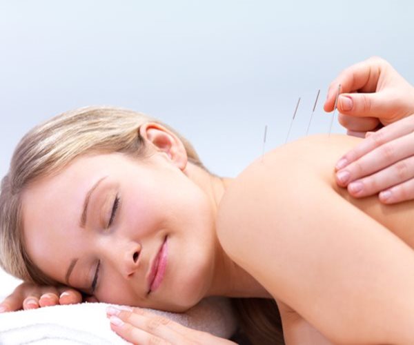 Acupuncture Can Reduce Menopausal Hot Flashes