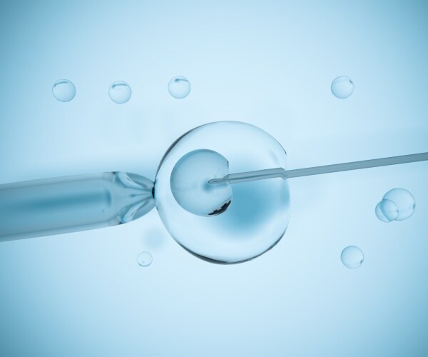 3D illustration of IVF procedure