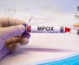 CDC Concerned About New Mpox Strain Spread in Africa