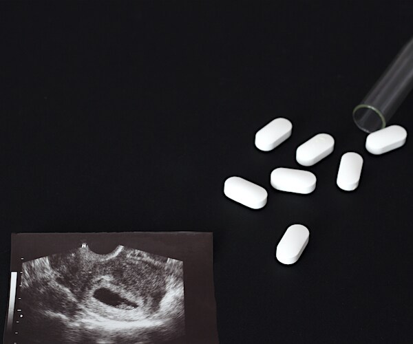 Uzi shot, pills and test tube on a black background, abortion, close-up pills