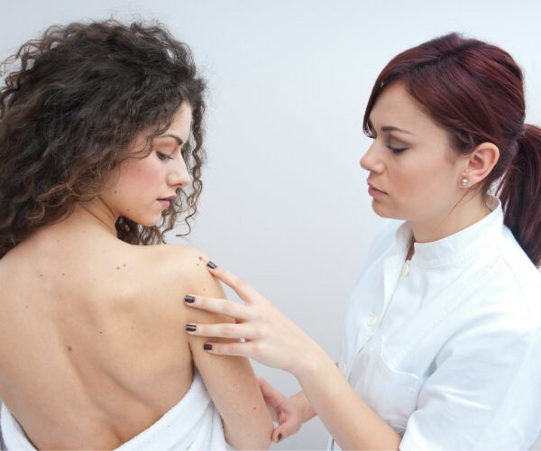 Moles on Your Arm Flag Skin Cancer Risk