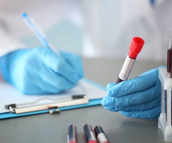 worker in lab logging in blood samples in vials