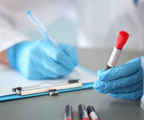 scientist holding a vial of blood for blood test