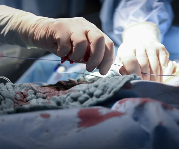 heart surgery being performed