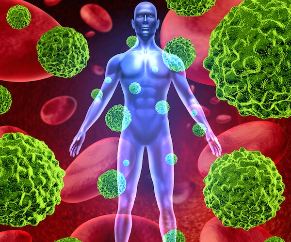 Tumors Light Up With 'Nanodots'