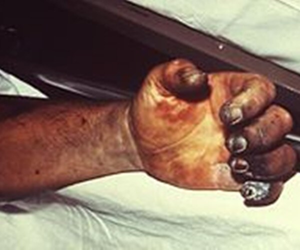 Ancient Plague Genome Reconstructed from 6th Century Victim's Teeth