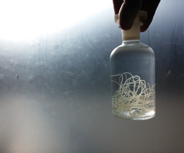 Moving Lump on Woman's Face? You Guessed It — a Worm