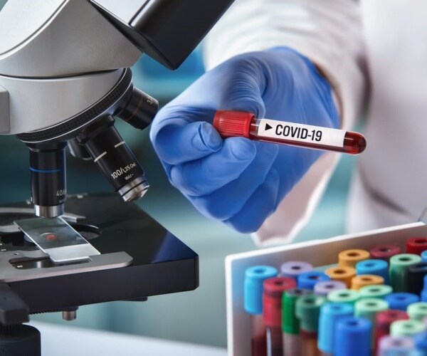 blood test for COVID