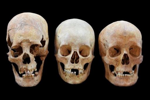 Skulls Show Women Moved across Medieval Europe, Not Just Men