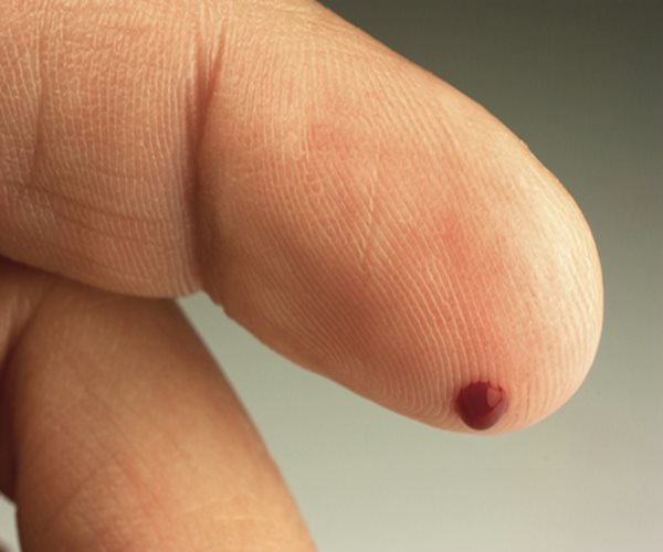 Pin-Prick Blood Test Spots Deadly Sepsis