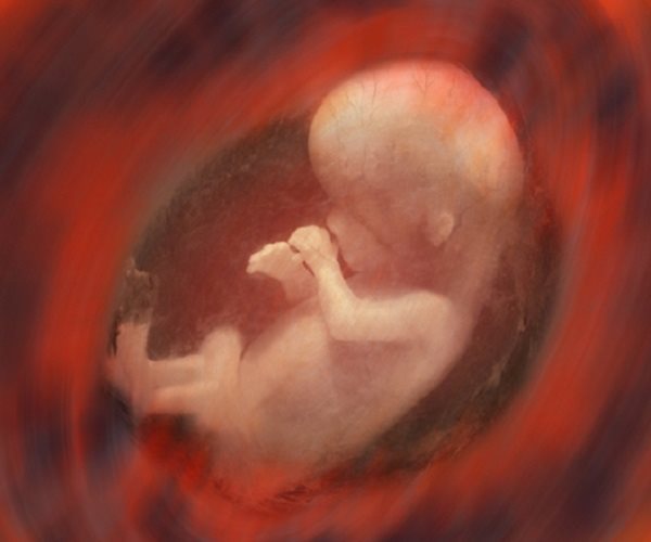 Fetal Immune System May Spark Premature Birth