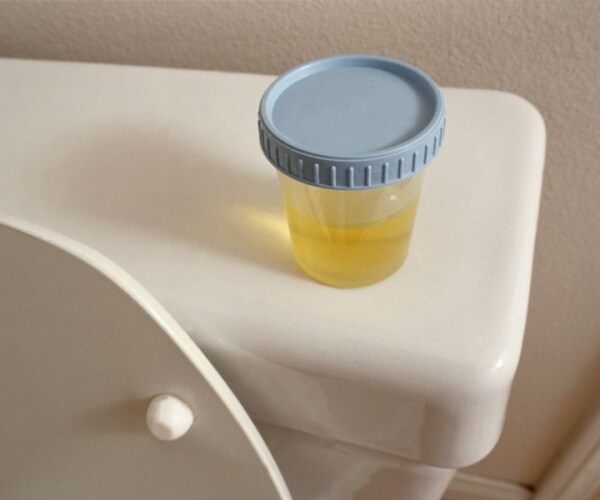 urine sample in collection cup on back of toilet