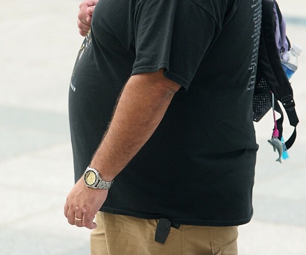 Study Finds Weight-Loss Surgery Added 3 Years to Life