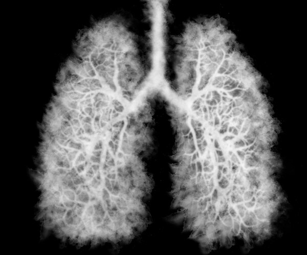 Smoke in lungs