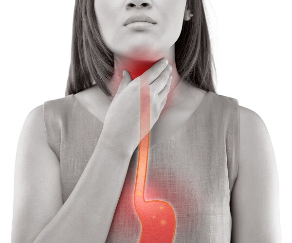 How to Get Relief from GERD