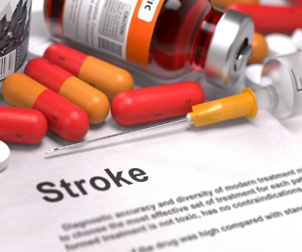 Antidepressant Shows Promise in Stroke Recovery