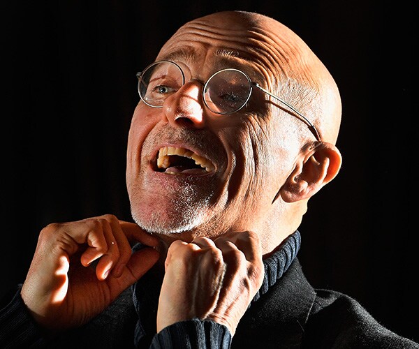 Human Head Transplant Surgeon Says Trial Run Is a Success