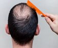 Scientists Develop System to Regrow Hair Like 'Wildfire'