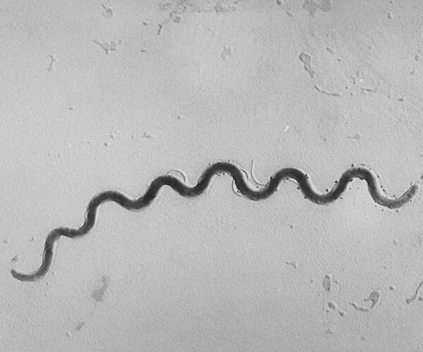 microscopic view of bacterium that causes syphilis