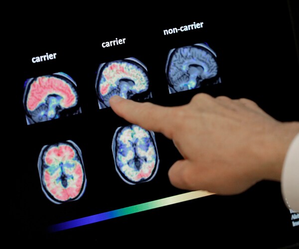 A doctor looks at brain scans