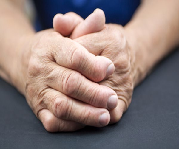 Some Jobs Raise Risk of Rheumatoid Arthritis