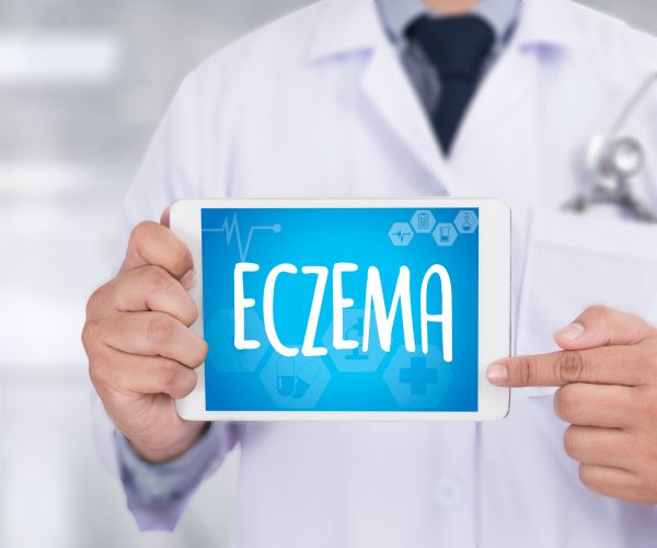 Many Options Available for Treating Eczema (Atopic Dermatitis)