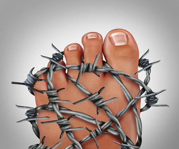 DASH Diet Lowers Risk of Gout