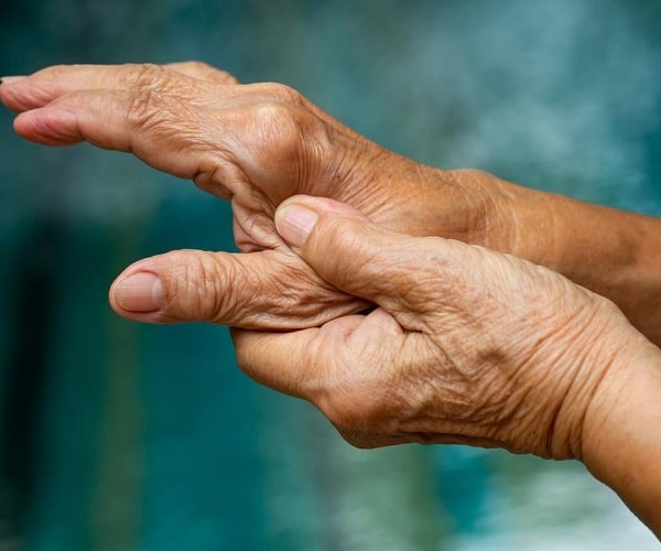 hands with arthritis