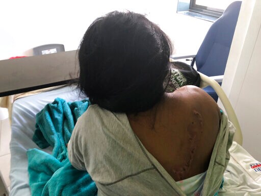 Survivor Recounts Confused, Chaotic Cult Rite That Killed 7