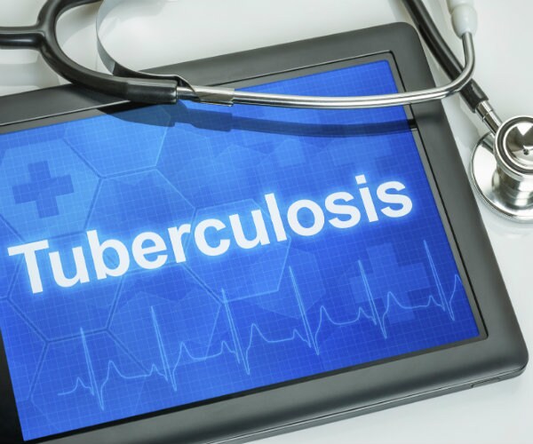 US TB Cases Rise For First Time in 23 Years: CDC